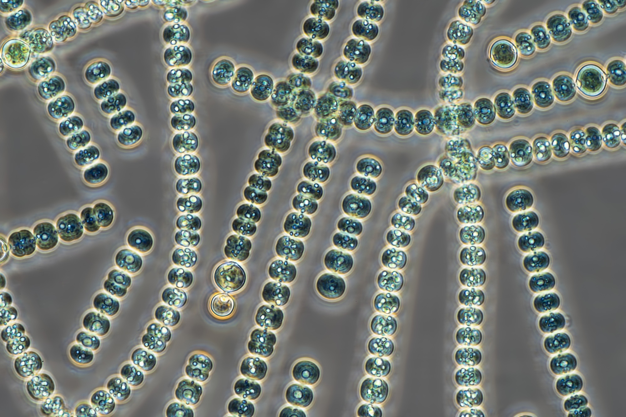 Image 1 pour Finally, some oxygen to breathe! : <h6>© Science Photo LibraryFox, Frank</h6>