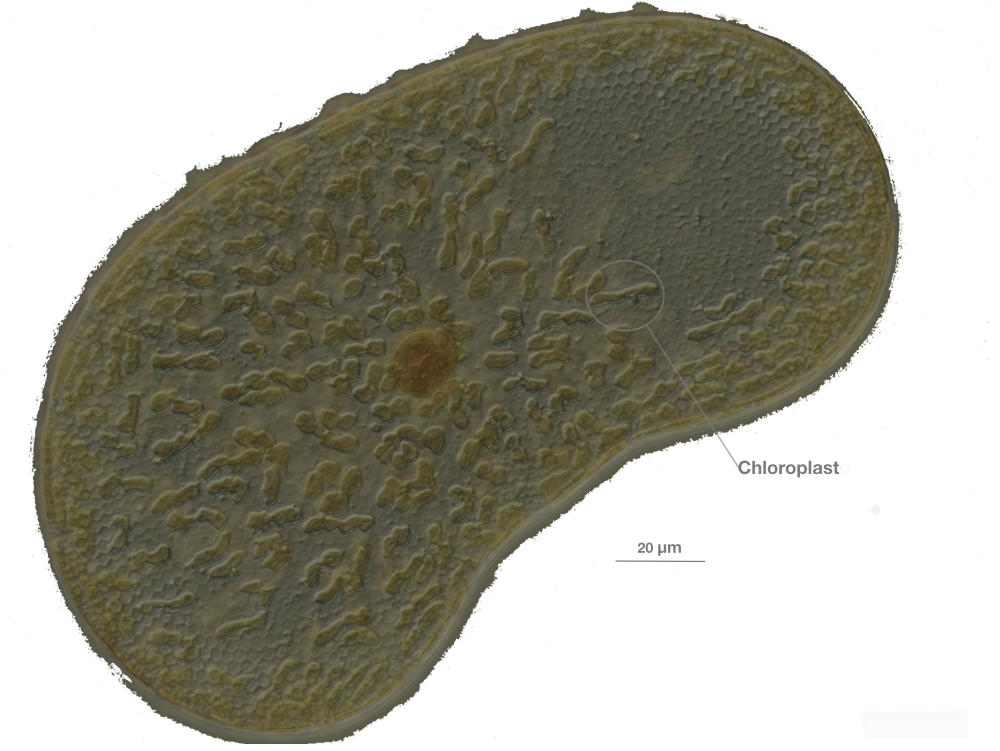 Image 1 pour The mysterious origin of eukaryotes : <p>Micro-algue unicellulaire de la famille des diatomées observée au microscope.<br>
Les diatomées sont apparues il y a seulement 200 millions d'années, longtemps après les premières algues rouges.</p><h6>© Observatoire Océanologique de Villefrance-sur-Mer</h6>